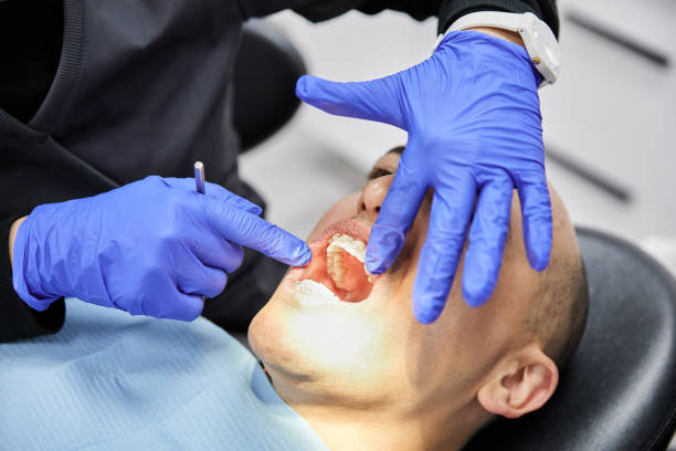 Best Emergency Treatment for Dental Infections or Abscesses in Merchantville, NJ