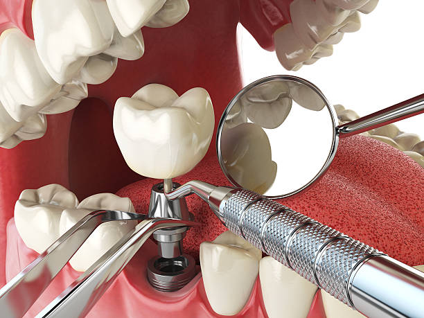 Best Emergency Dental Care for Broken or Chipped Teeth in Merchantville, NJ